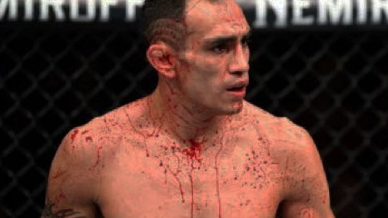 Tony Ferguson